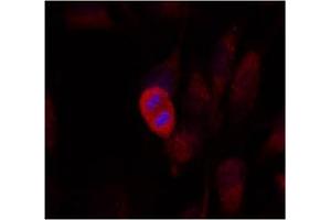 Image no. 2 for anti-Mitogen-Activated Protein Kinase Kinase 4 (MAP2K4) (Thr261) antibody (ABIN197323) (MAP2K4 Antikörper  (Thr261))