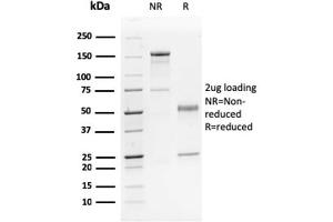 SDS-PAGE Analysis Purified p63 Mouse Monoclonal Antibody (TP63/2428). (p63 Antikörper)