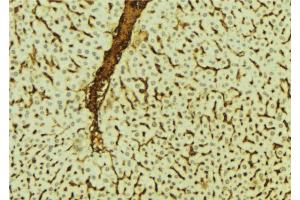 ABIN6273540 at 1/100 staining Mouse liver tissue by IHC-P.