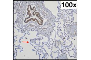 Typical pulmonal findings in AQP-5 (aquaporin-5) immunohistochemistry (right lower lobe, 73-year-old woman with chronic emphysema): Strongly positive bronchial epithelium (upper left corner) next to negative pneumocytes type I (exemplary marked with an arrow) Source: PMID34181078