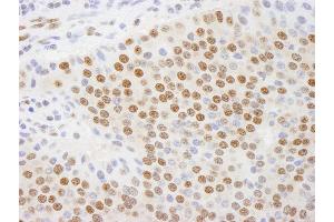 Immunohistochemistry (IHC) image for anti-C-terminal Binding Protein 1 (CTBP1) (AA 400-440) antibody (ABIN7448499) (CTBP1 Antikörper  (AA 400-440))