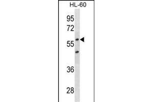 CDKN1C Antibody (ABIN1539930 and ABIN2843870) western blot analysis in HL-60 cell line lysates (35 μg/lane). (CDKN1C Antikörper  (AA 34-64))