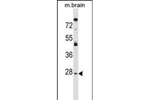 AQP1 Antibody (C-term) (ABIN1536913 and ABIN2849410) western blot analysis in mouse brain tissue lysates (35 μg/lane). (Aquaporin 1 Antikörper  (C-Term))