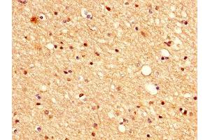 IHC image of ABIN7175396 diluted at 1:500 and staining in paraffin-embedded human brain tissue performed on a Leica BondTM system.