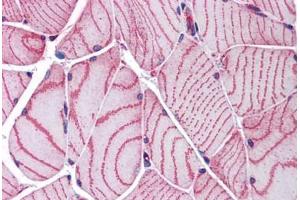 Human Skeletal Muscle: Formalin-Fixed, Paraffin-Embedded (FFPE) (ACTN2 Antikörper  (AA 215-500))