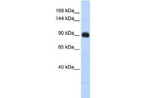 WB Suggested Anti-MATN2 Antibody Titration: 0. (MATN2 Antikörper  (Middle Region))