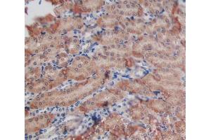 Used in DAB staining on fromalin fixed paraffin- embedded kidney tissue (GALNS Antikörper  (AA 168-377))