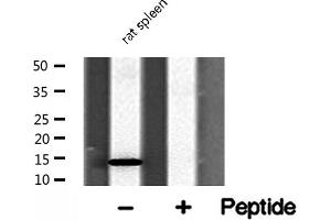 Western blot analysis of RPL31 Antibody expression in rat spleen tissue lysates. (RPL31 Antikörper  (Internal Region))