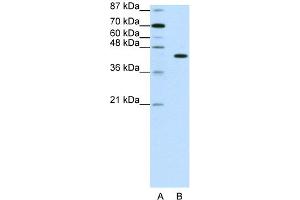 WB Suggested Anti-PGBD1 Antibody Titration:  1.