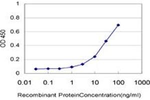 Detection limit for recombinant GST tagged ALDH2 is approximately 1ng/ml as a capture antibody. (ALDH2 Antikörper  (AA 408-517))