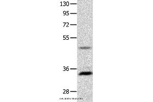 Western blot analysis of Mouse intestinum tenue tissue  , using MC1R Polyclonal Antibody at dilution of 1:1450