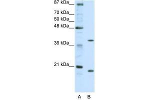 ZNF322A antibody used at 0.