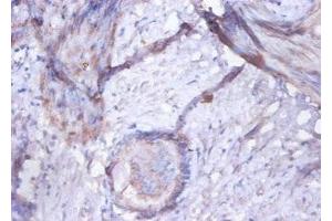 Immunohistochemistry of paraffin-embedded human prostate tissue using ABIN7154292 at dilution of 1:100 (GOLM1 Antikörper  (AA 36-401))
