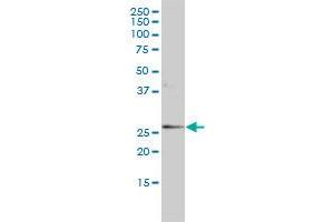 ORM1 monoclonal antibody (M01), clone 2F9-1F10 Western Blot analysis of ORM1 expression in MCF-7 . (ORM1 Antikörper  (AA 18-201))