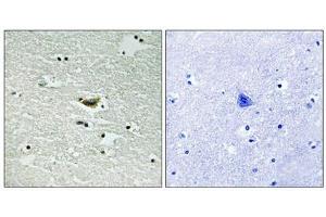 Immunohistochemical analysis of paraffin-embedded human brain tissue using CK-1α (Phospho-Tyr294) antibody (left)or the same antibody preincubated with blocking peptide (right). (CSNK1A1 Antikörper  (pTyr294))