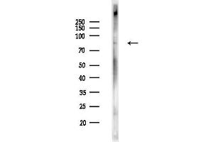 Western blot analysis of lysates from PC12 cells(heat-shock,45 min treatment), using Phospho-DR6 (Ser562) Antibody at 1/1000 dilution.