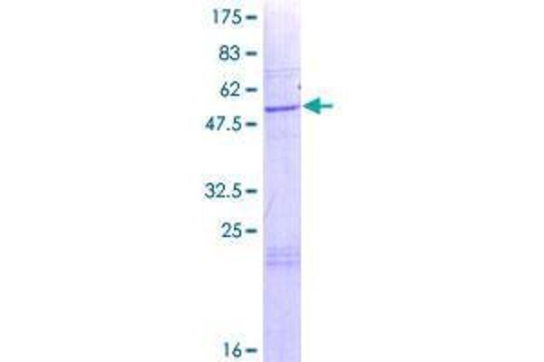 THEM4 Protein (AA 1-240) (GST tag)