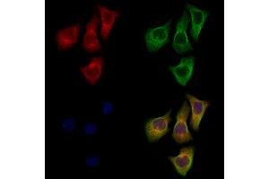 ABIN7094718 and ABIN7098769 staining Hela cells by IF/ICC. (DPP6 Antikörper  (Catalytic Domain, Internal Region))