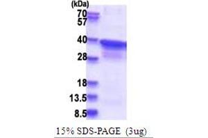 SDS-PAGE (SDS) image for Polymerase (RNA) II (DNA Directed) Polypeptide C, 33kDa (POLR2C) (AA 1-275) protein (His tag) (ABIN5853761)