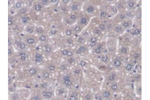 Figure. (DNAJC2 Antikörper  (AA 368-621))