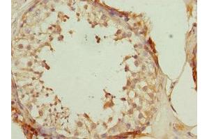 Immunohistochemistry of paraffin-embedded human testis tissue using ABIN7150764 at dilution of 1:100 (DUSP22 Antikörper  (AA 1-184))