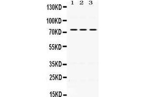 Western Blotting (WB) image for anti-Interleukin 2 Receptor, beta (IL2RB) (AA 503-539), (C-Term) antibody (ABIN3043246) (IL2 Receptor beta Antikörper  (C-Term))