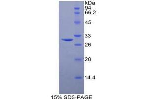 SDS-PAGE analysis of Human Sphingosine Kinase 1 Protein. (SPHK1 Protein)
