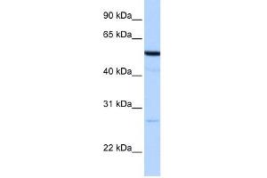 REEP4 antibody used at 1 ug/ml to detect target protein. (Receptor Accessory Protein 4 Antikörper  (N-Term))
