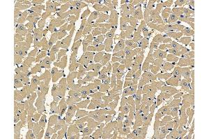 ABIN7096925 and ABIN7100991 at 1/100 staining rat heart tissue by IHC-P.
