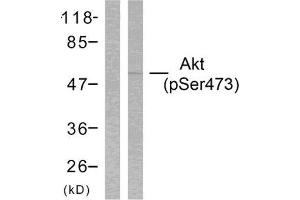 Western Blotting (WB) image for anti-V-Akt Murine Thymoma Viral Oncogene Homolog 1 (AKT1) (pSer473) antibody (ABIN1847446) (AKT1 Antikörper  (pSer473))