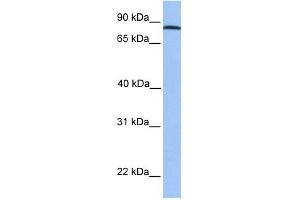 ADAM7 antibody used at 1 ug/ml to detect target protein. (ADAM7 Antikörper  (C-Term))