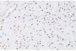 Immunohistochemistry (Paraffin-embedded Sections) (IHC (p)) image for anti-FK506 Binding Protein 4, 59kDa (FKBP4) antibody (ABIN7261592)