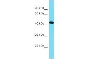 Host: Rabbit Target Name: C16orf91 Sample Type: Fetal Lung lysates Antibody Dilution: 1. (CCSMST1 Antikörper  (C-Term))