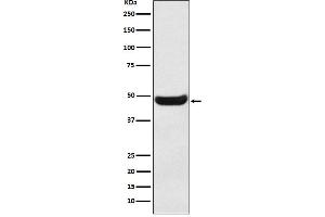 Western blot analysis of BHMT expression in Human fetal kidney lysate.
