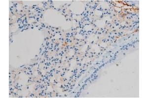 ABIN6267410 at 1/200 staining Mouse lung tissue sections by IHC-P. (Connexin 43/GJA1 Antikörper  (pSer368))