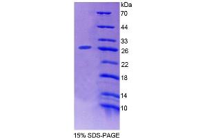 SDS-PAGE (SDS) image for Ecto-NOX Disulfide-Thiol Exchanger 2 (ENOX2) (AA 1-207) protein (His tag) (ABIN4989266)