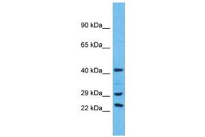 Western Blotting (WB) image for anti-Ubiquitin Specific Peptidase 41 (USP41) (C-Term) antibody (ABIN2791978) (USP41 Antikörper  (C-Term))