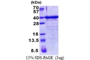 SDS-PAGE (SDS) image for Zinc Finger Protein 346 (ZNF346) (AA 1-294) protein (His tag) (ABIN5853212) (ZNF346 Protein (AA 1-294) (His tag))