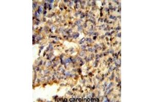 Immunohistochemistry (IHC) image for anti-Fc Fragment of IgG, Low Affinity IIc, Receptor For (CD32) (FCGR2C) antibody (ABIN3003995) (FCGR2C Antikörper)