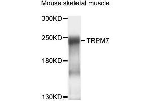Western blot analysis of extracts of mouse skeletal muscle cells, using TRPM7 antibody. (TRPM7 Antikörper)