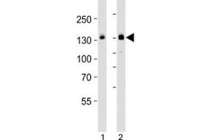 Western blot analysis of lysate from HT-29 cell line and mouse spleen tissue lysate (left to right) using JAK1 antibody; Ab was diluted at 1:1000 for each lane. (JAK1 Antikörper  (C-Term))