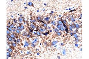 Immunohistochemical staining on a rat brain section for Syntaxin 6. (Syntaxin 6 Antikörper  (AA 6-136))