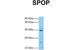 Host:  Rabbit  Target Name:  SPOP  Sample Tissue:  Human MCF7  Antibody Dilution:  1. (SPOP-B Antikörper  (C-Term))