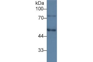 Western Blot; Sample: Human HepG2 cell lysate; Primary Ab: 3µg/ml Mouse Anti-Human C1INH Antibody Second Ab: 0. (SERPING1 Antikörper  (AA 399-500))