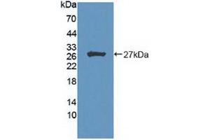 Figure. (HIPK2 Antikörper  (AA 977-1198))