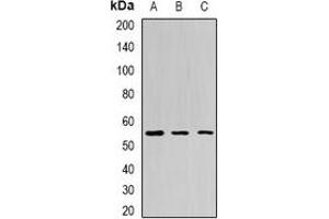 Western blot analysis of BPI expression in Jurkat (A), HepG2 (B), mouse liver (C) whole cell lysates. (BPI Antikörper)