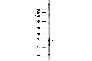anti-Histamine N-Methyltransferase (HNMT) (Internal Region) antibody