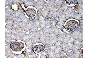 IHC analysis of Crp using anti- Crp antibody . (CRP Antikörper  (AA 20-225))