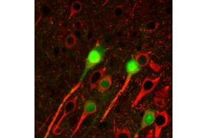 Immunohistochemistry staining of betaIII tubulin (red) in tissue sections of murine brain expressing GFP in some of its neurons (green).