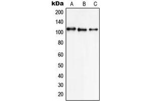 Western blot analysis of NCX1 expression in K562 (A), A549 (B), HL60 (C) whole cell lysates. (SLC8A1 Antikörper  (Center))